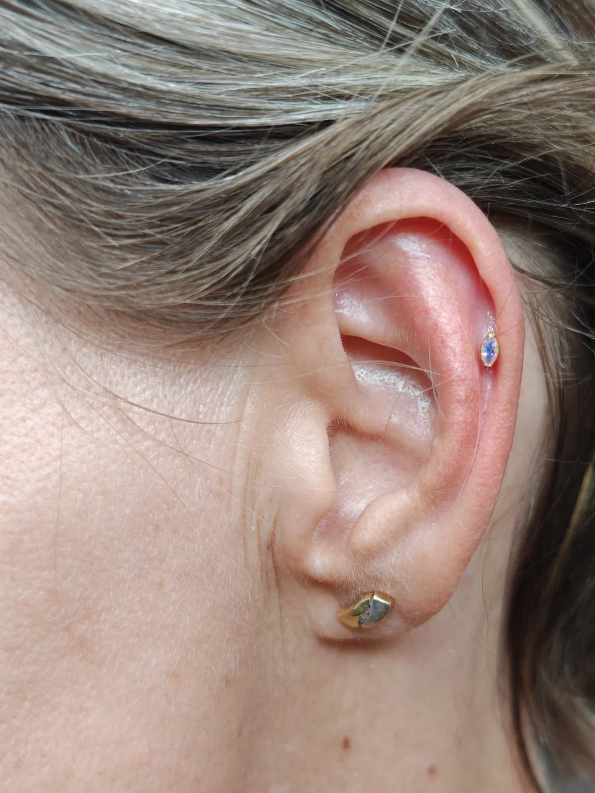 Allergia piercing – akupunktúrás piercing titánium ékszerrel