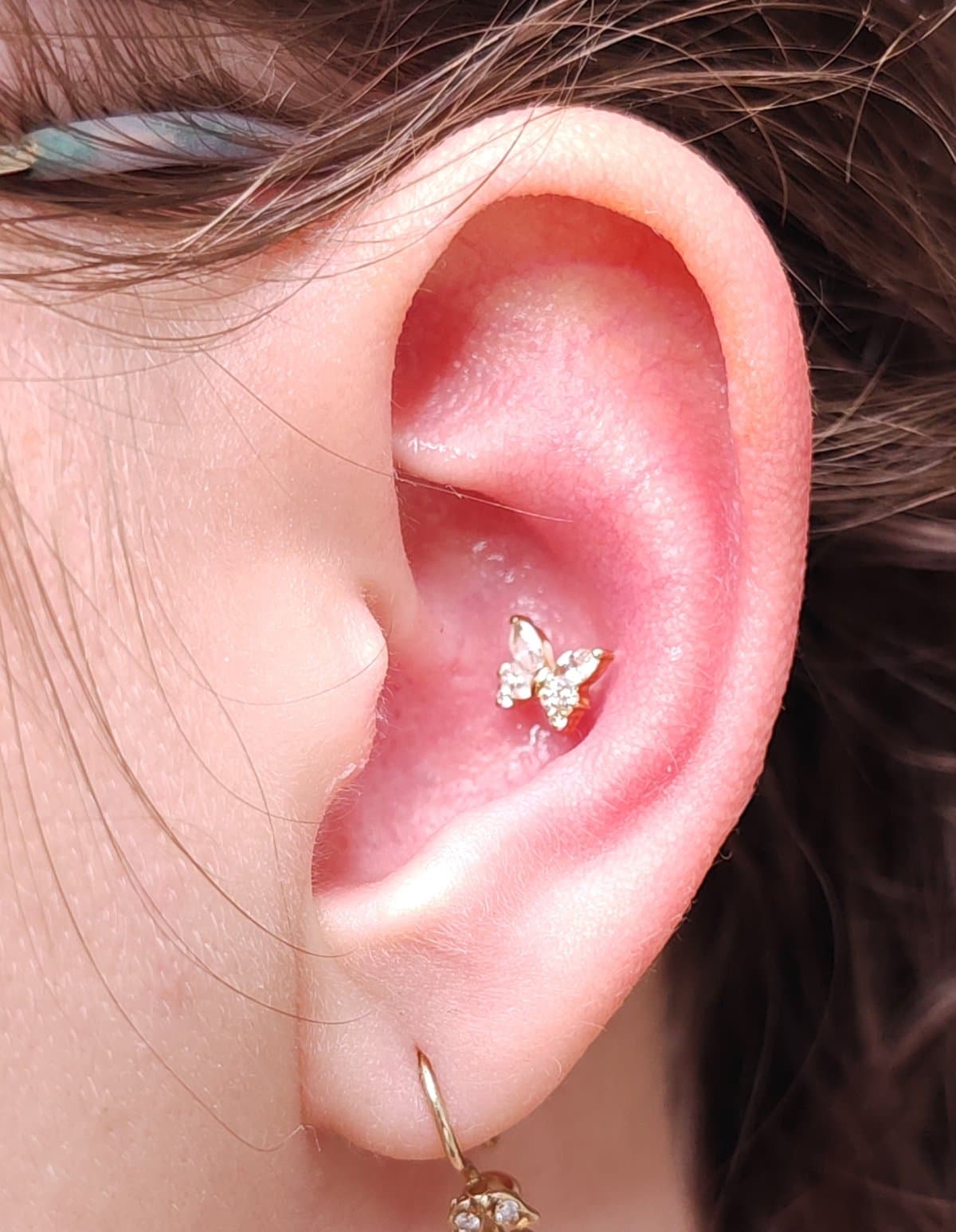 Máj piercing – akupunktúrás piercing titánium ékszerrel